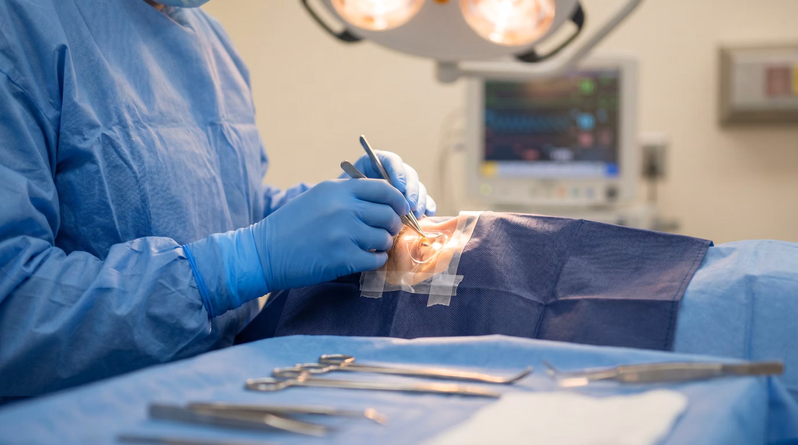 Cirurgia de catarata tem risco? Tudo que você precisa saber antes de operar