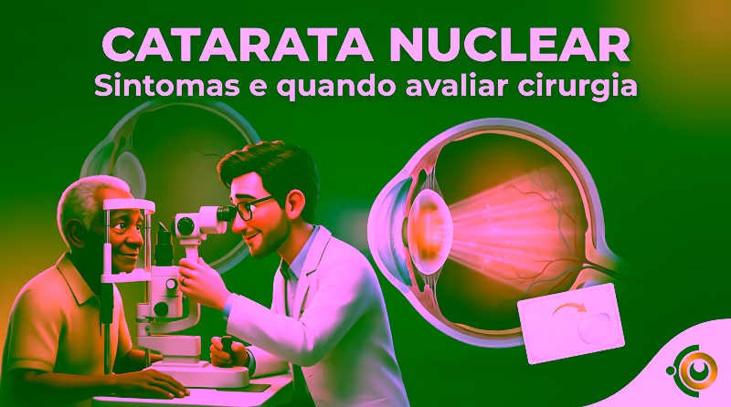 Capa ilustrativa do artigo "Catarata nuclear: sintomas, mudança de grau e quando avaliar cirurgia" sobre catarata no blog da Drudi e Almeida Oftalmologia.