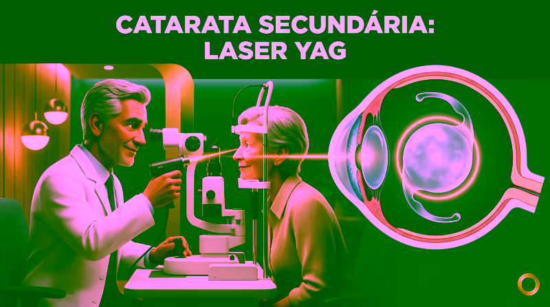 Capa ilustrativa do artigo "Catarata secundária: sintomas e tratamento com YAG" sobre catarata no blog da Drudi e Almeida Oftalmologia.