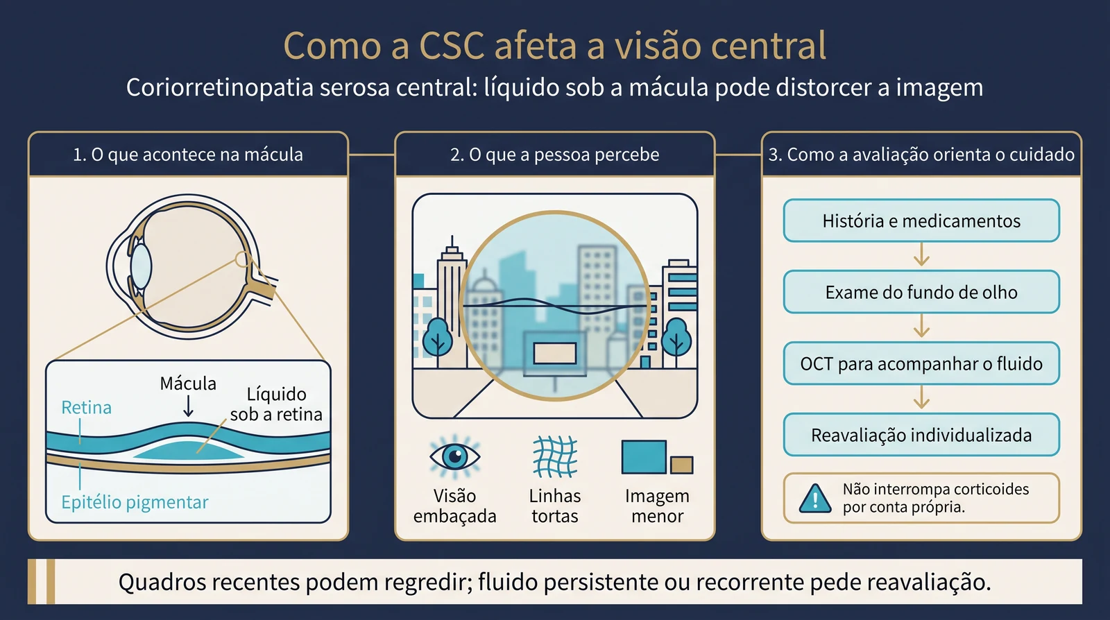 Prancha clínica explicando como o líquido sob a mácula pode distorcer a visão central e como a avaliação com OCT orienta o acompanhamento da coriorretinopatia serosa central.
