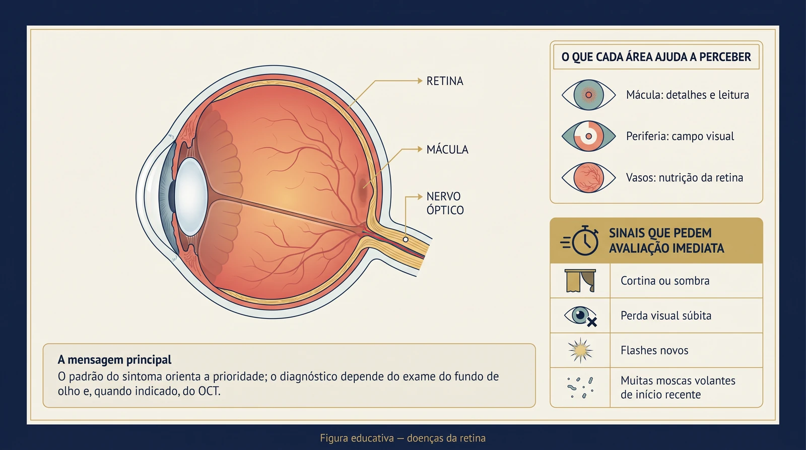 Prancha clínica com anatomia da retina, mácula, nervo óptico, padrões visuais e sinais que exigem avaliação imediata