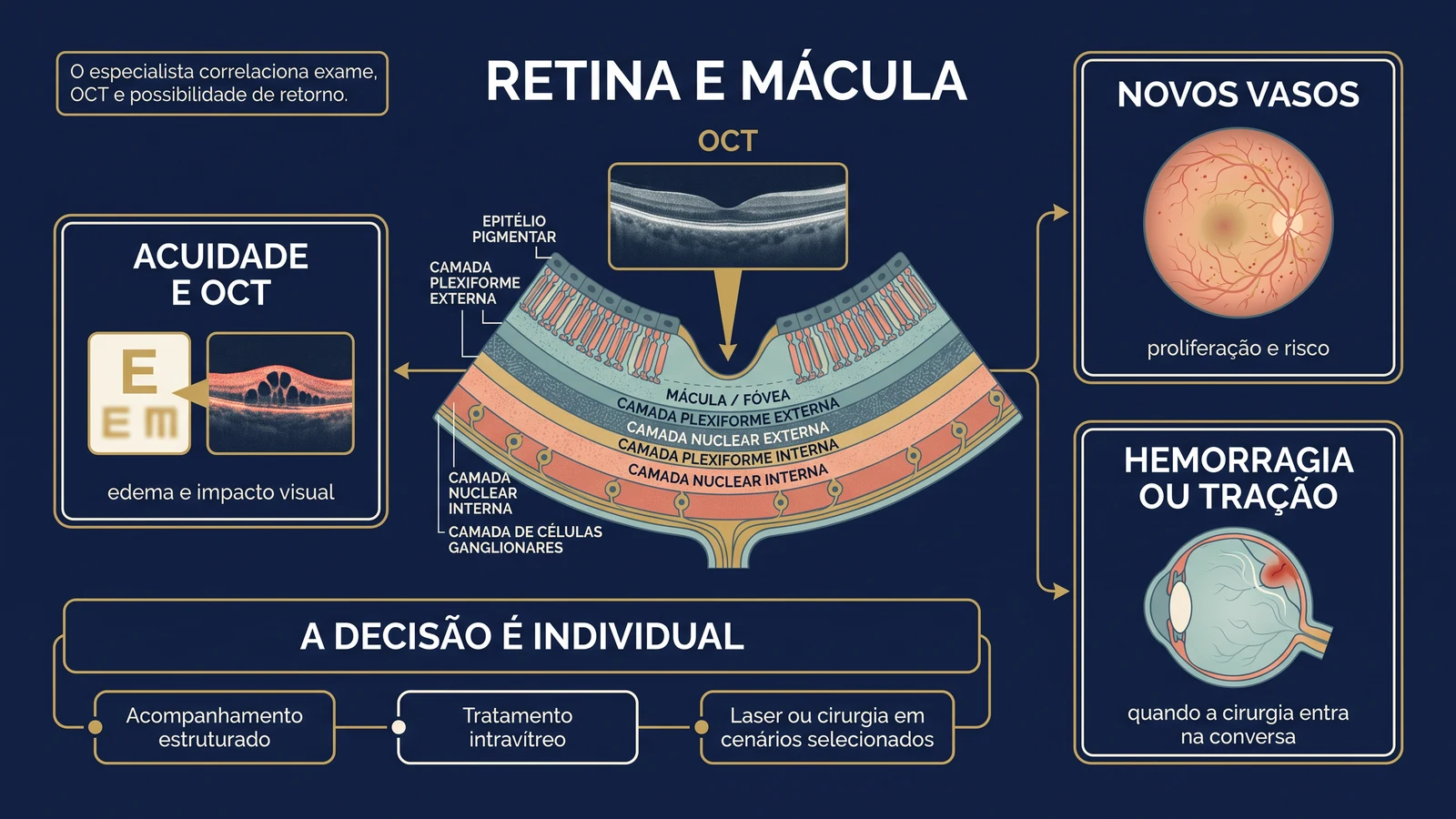 Prancha clínica mostrando retina e mácula com OCT e os fatores que orientam a decisão entre acompanhamento, tratamento intravítreo, laser ou cirurgia na retinopatia diabética.