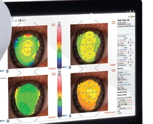 Tela do tomógrafo de córnea com quatro mapas coloridos da curvatura e da espessura da córnea
