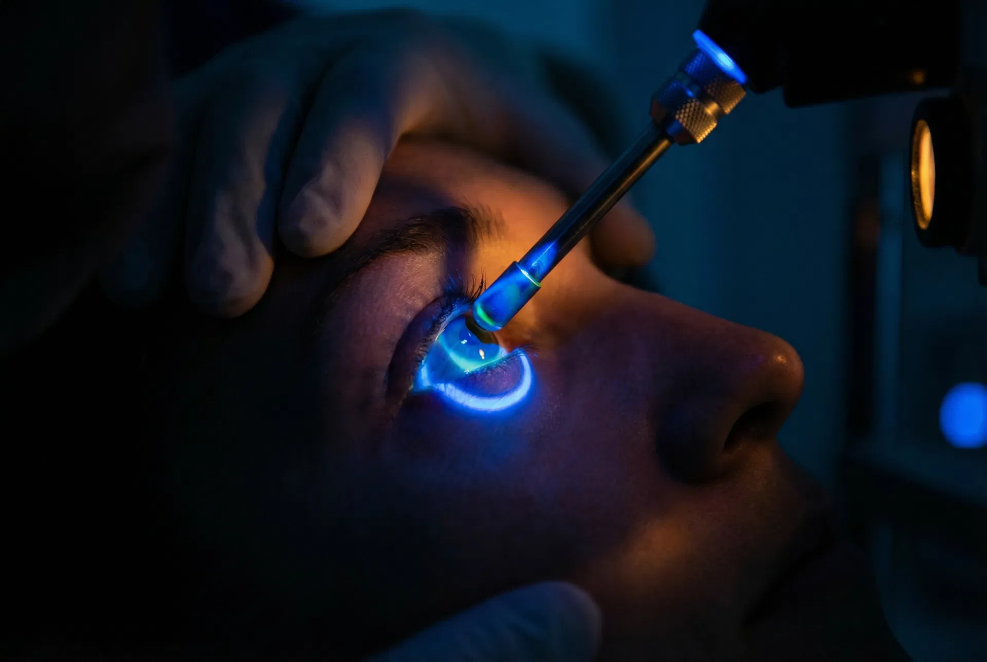 Tonometria de aplanação de Goldmann — medida da pressão intraocular com luz azul fluorescente