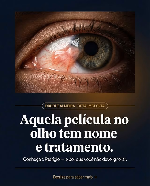 Carrossel: Aquela película no olho tem nome — e você não deve ignorar. 👁️