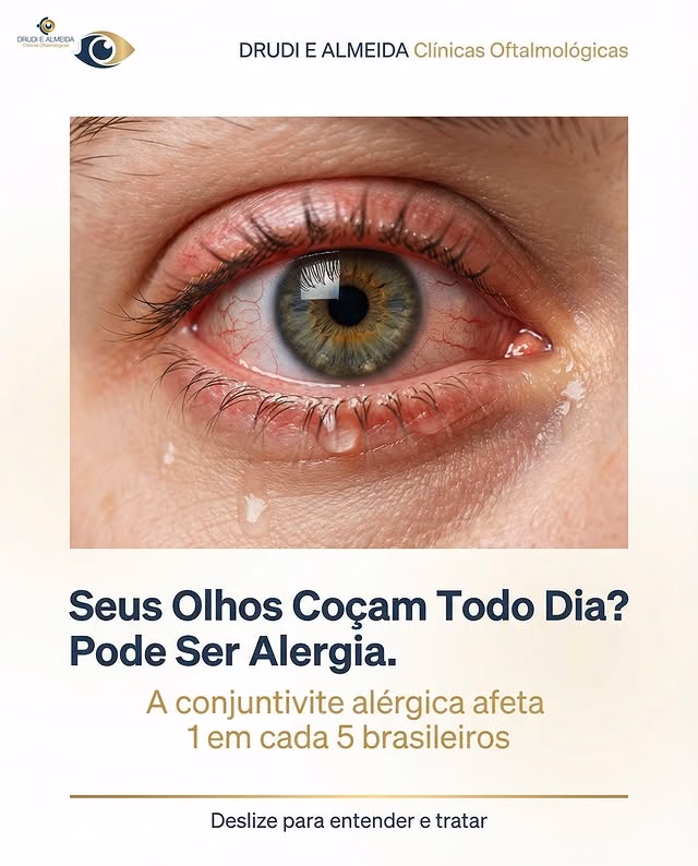 Carrossel: Seus olhos cocam todo dia? Não ignore esse sinal.