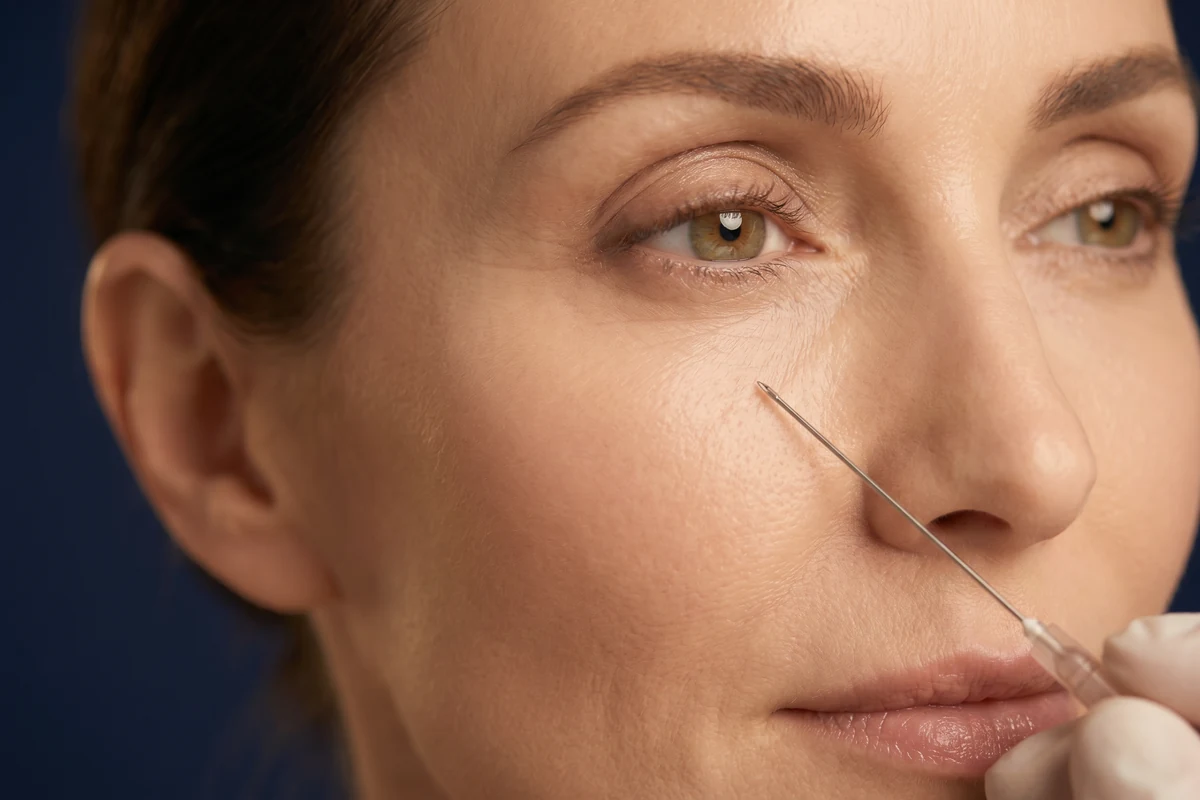 Preenchedores de Ácido Hialurônico — Instituto de Plástica Facial